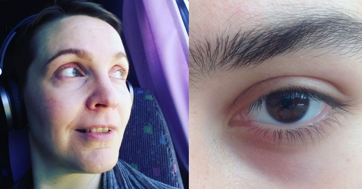 Eine Frau mit Augenschatten und ein rangezoomtes Auge mit Augenringen