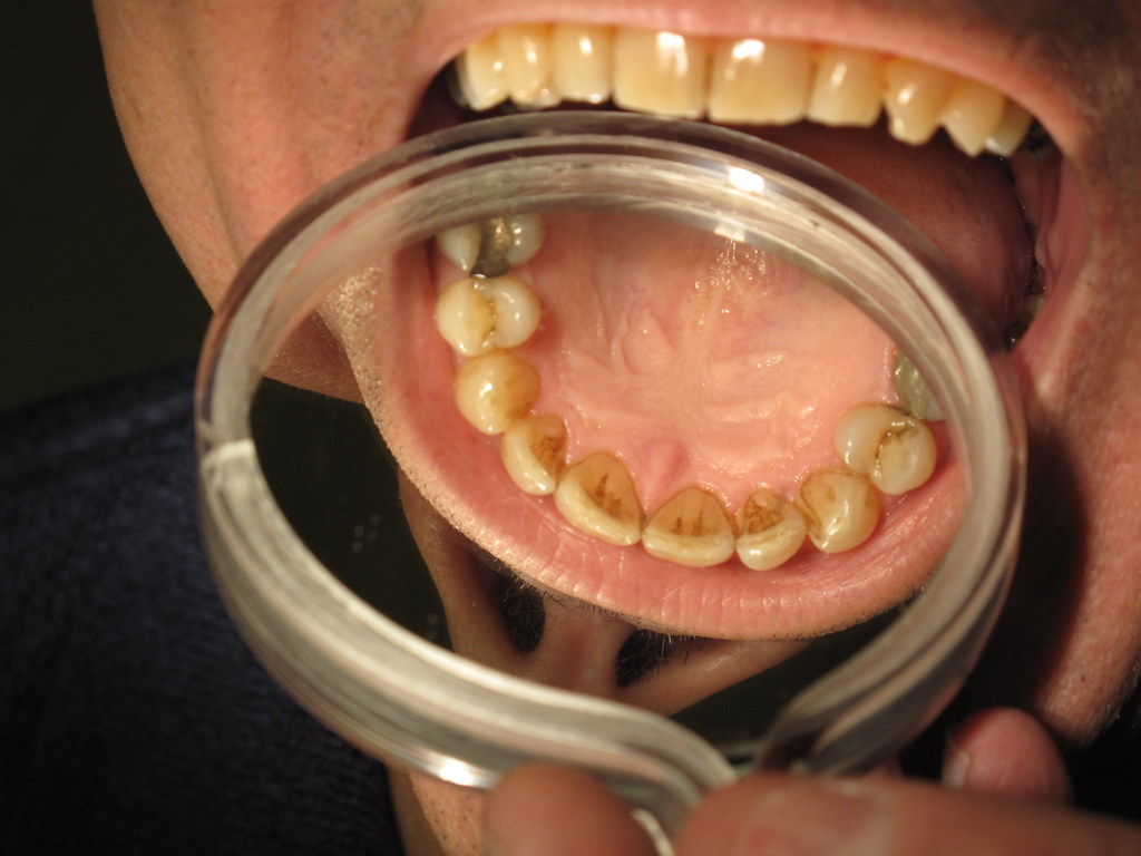 dentist visit in kearny, nj