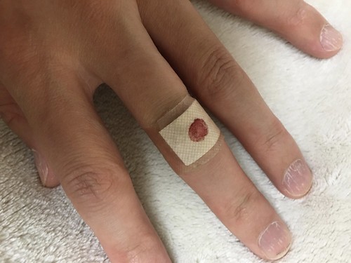 Plaster