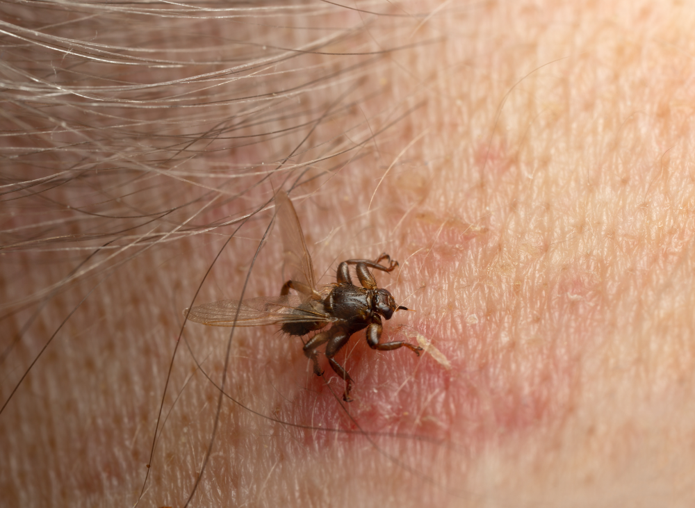 Haut wird von fliegender Zecke gebissen