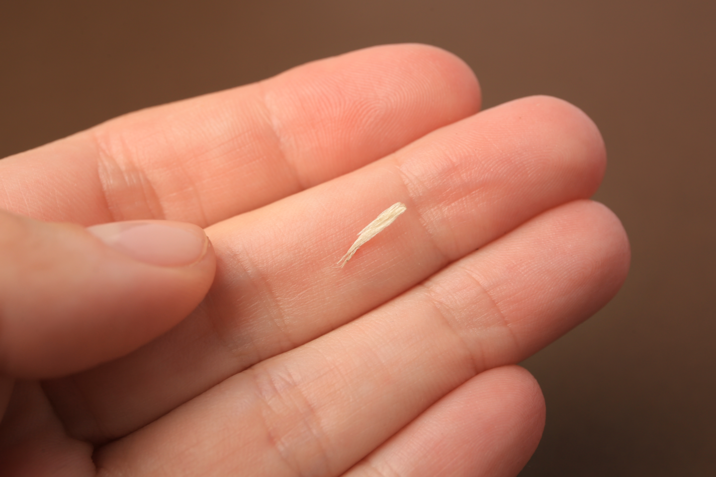 Ein Holzsplitter auf einer Hand. Mithilfe von Natron lassen sich Splitter ganz leicht entfernen.