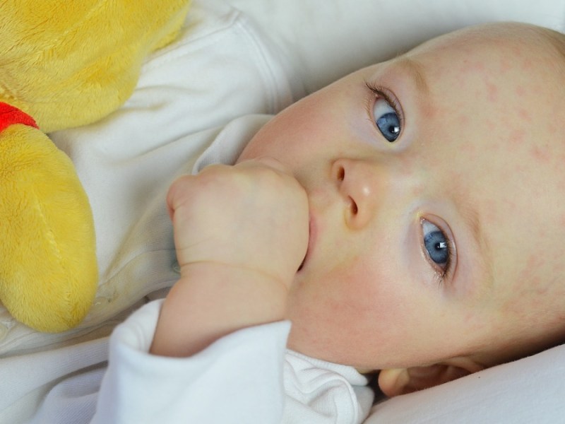 Baby mit gerötetem Gesicht liegt in einem Bettchen