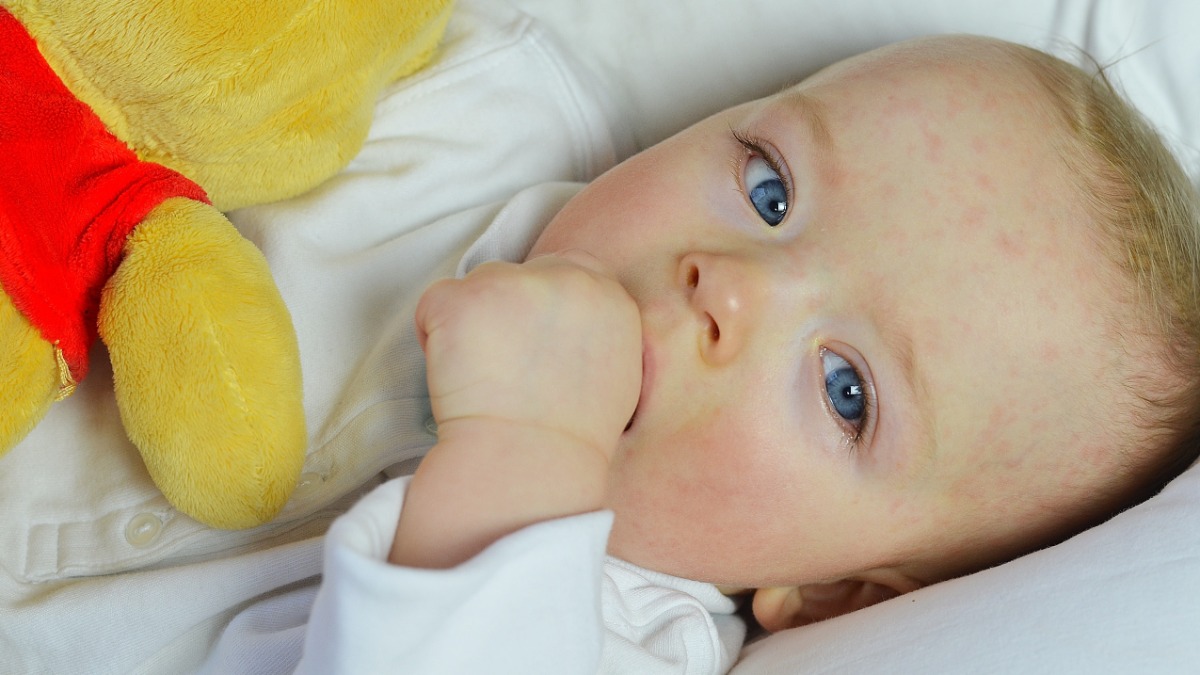 Baby mit gerÃ¶tetem Gesicht liegt in einem Bettchen